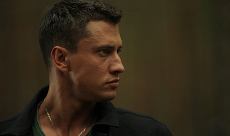 Павел Прилучный после удаления опухоли сильно изменился