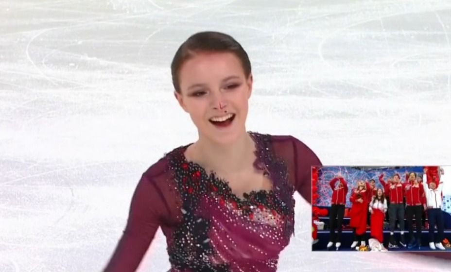 У олимпийской чемпионки пошла кровь во время выступления. 
Фото: скриншот трансляции 
