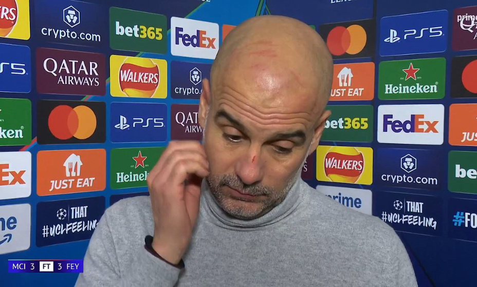 Гвардиола сам расцарапал себе лицо. Фото: соцсети